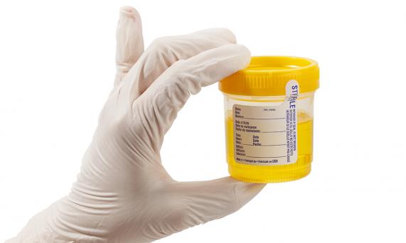 urine sample