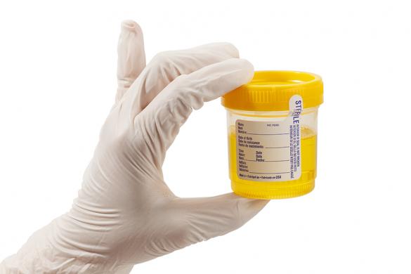 urine sample